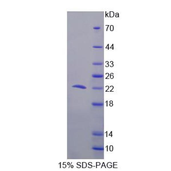 PDCD6蛋白；细胞程序性死亡蛋白6(PDCD6)重组蛋白