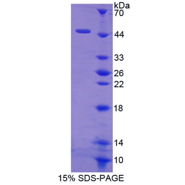 HBd蛋白；血红蛋白δ(HBd)重组蛋白