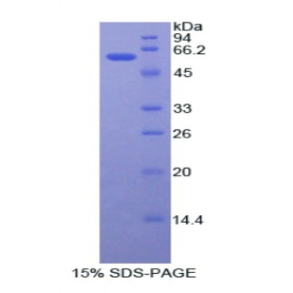 ADA蛋白；腺苷脱氨酶(ADA)重组蛋白