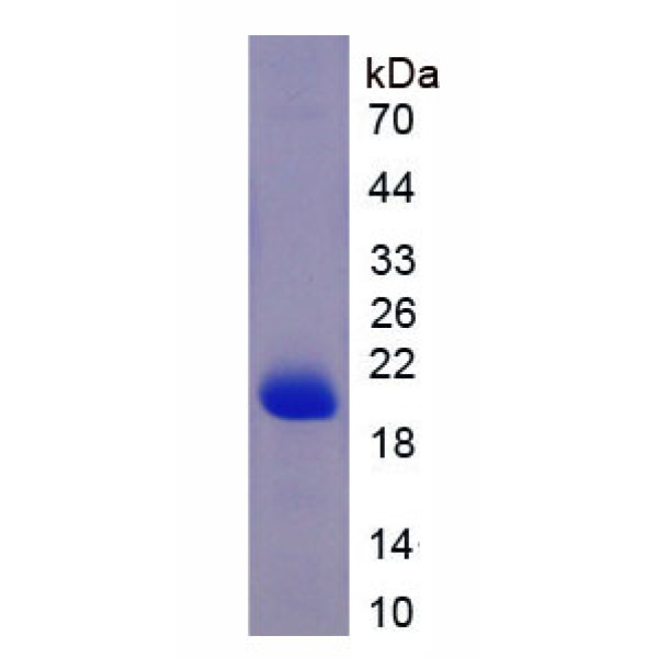 APOA5蛋白；载脂蛋白A5(APOA5)重组蛋白