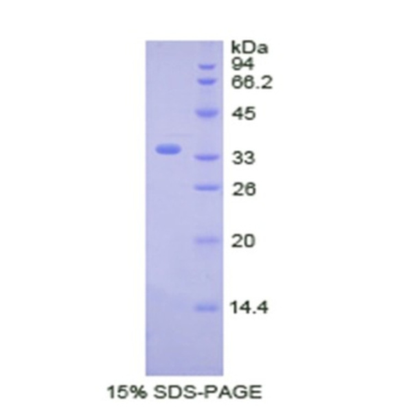 CDK4蛋白；周期素依赖性激酶4(CDK4)重组蛋白