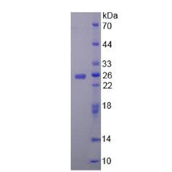 CHRNa4蛋白；烟碱型胆碱受体α4(CHRNa4)重组蛋白