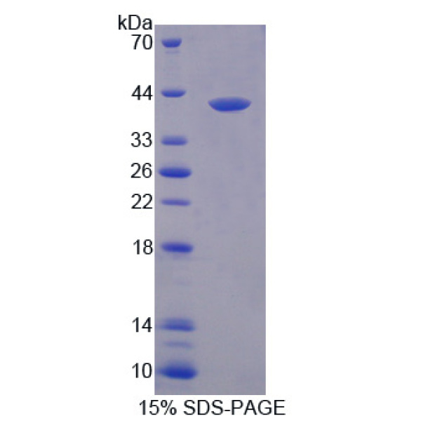 FAM19A3蛋白；序列相似家族19成员A3(FAM19A3)重组蛋白