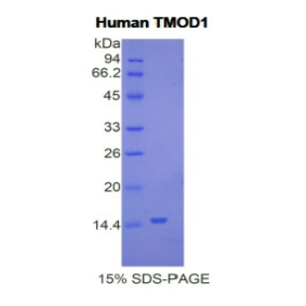 TMOD1蛋白；原肌球调节蛋白1(TMOD1)重组蛋白