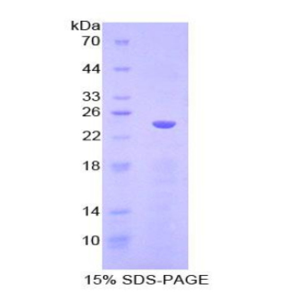 CDH5蛋白；血管内皮钙黏蛋白(CDH5)重组蛋白