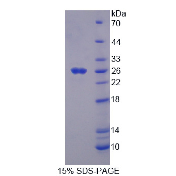 THBS1蛋白；血小板反应蛋白(THBS1)重组蛋白