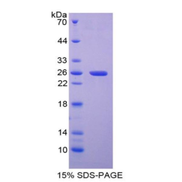 MAP1A蛋白；微管关联蛋白1A(MAP1A)重组蛋白