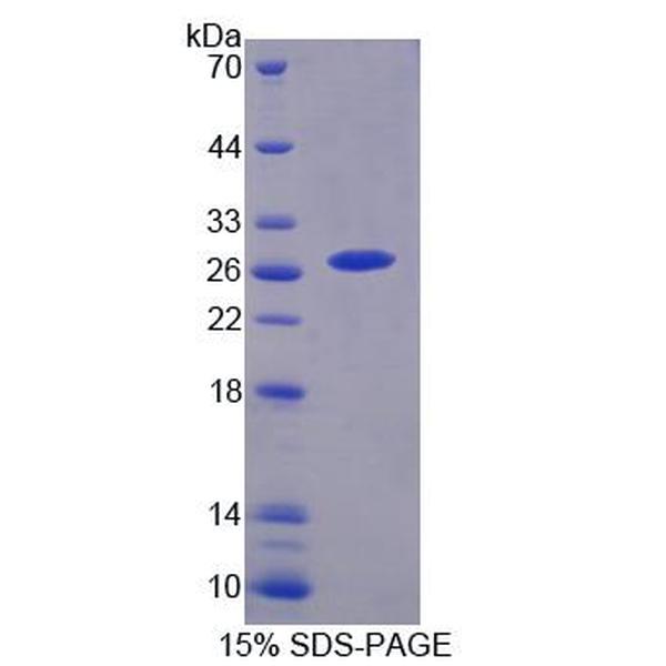 CHRNa3蛋白；烟碱型胆碱受体α3(CHRNa3)重组蛋白