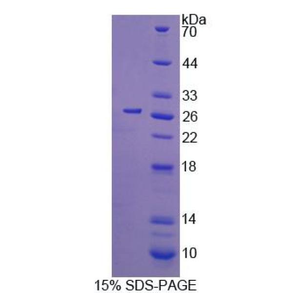 CDC42蛋白；细胞分裂周期因子42(CDC42)重组蛋白