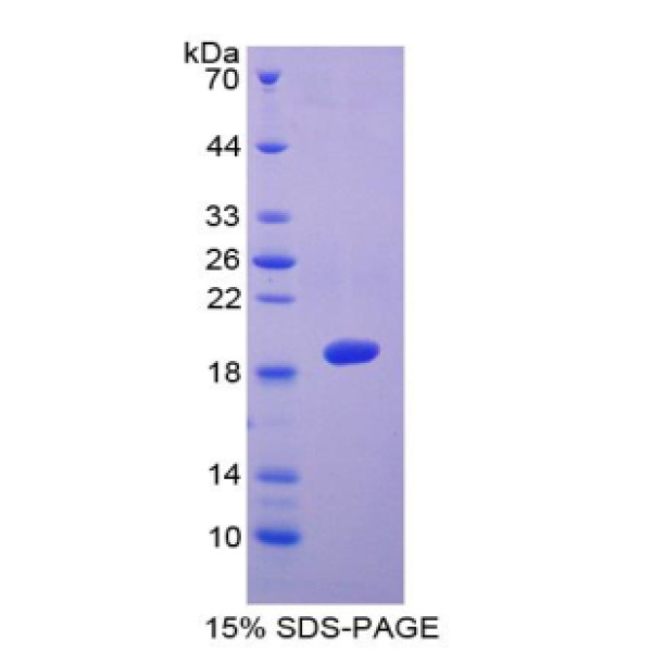 血小板反应蛋白解整合素金属肽酶5(ADAMTS5)重组蛋白