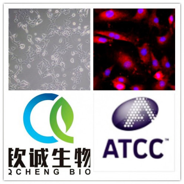 Cattle chondrocytes牛软骨细胞