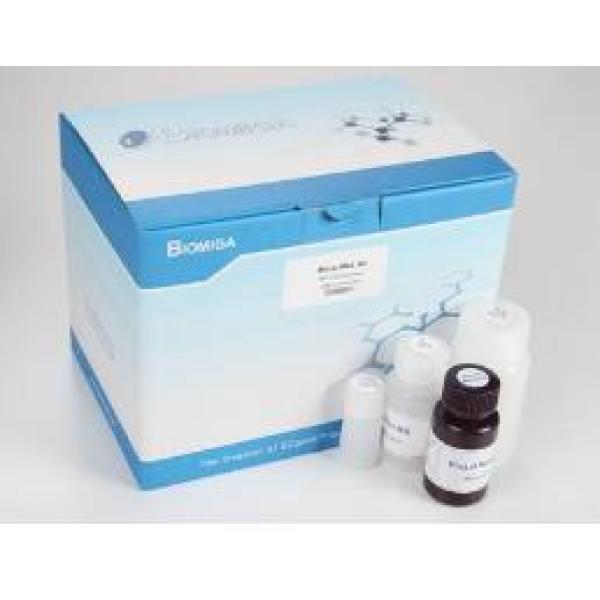 产肠毒素性大肠杆菌O139血清型染料法荧光定量PCR试剂盒