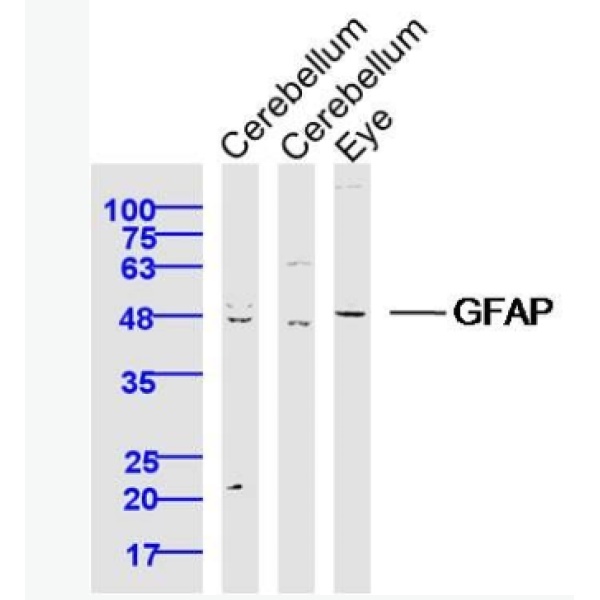 GFAP胶质纤维酸性蛋白抗体