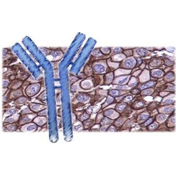 Ⅱ型胶原α1 N端前体肽抗体