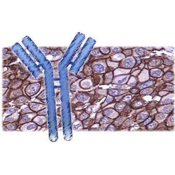 β1,4-N乙酰半乳糖氨基转移酶1抗体