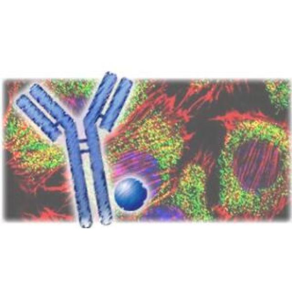 毛皮质细胞角蛋白/细胞角蛋白40抗体