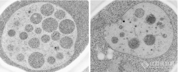 自噬小体电镜图片图片