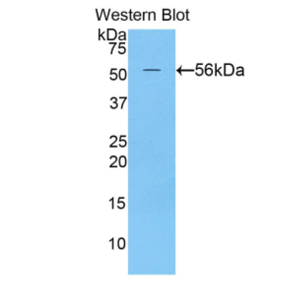 轴突生长诱向因子1(Ntn1)多克隆抗体