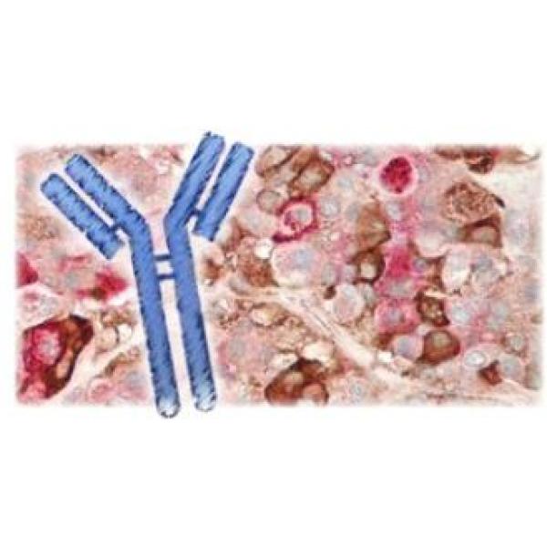 自噬微管相关蛋白轻链3单克隆抗体
