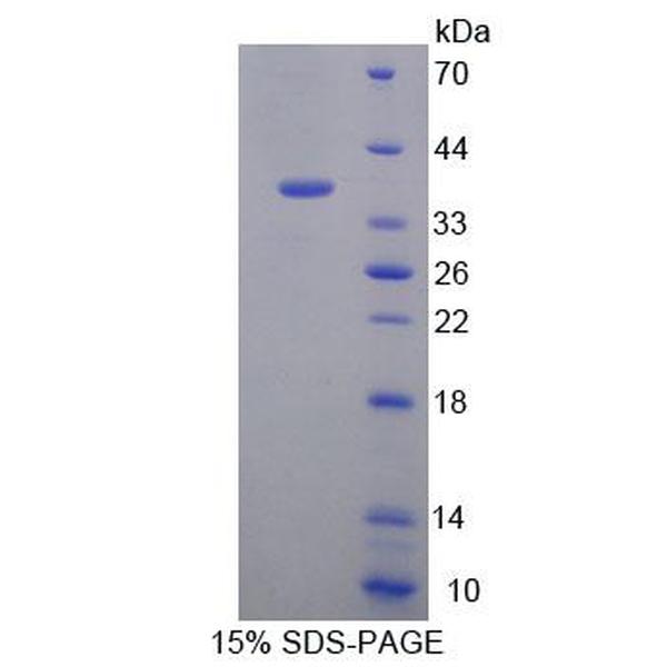 真核翻译延伸因子1δ(EEF1d)重组蛋白(多属种)