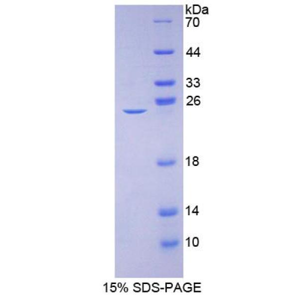 L-型电压依赖钙离子通道α1C亚基(CACNa1C)重组蛋白(多属种)