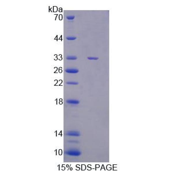 癌症易感性候选基因5(CASC5)重组蛋白(多属种)
