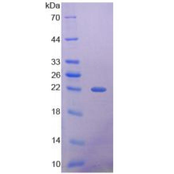 组蛋白脱乙酰基酶4(HDAC4)重组蛋白(多属种)