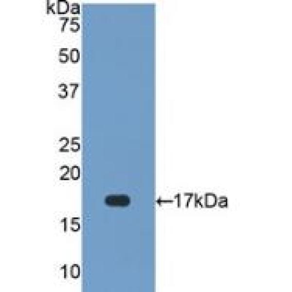 超氧化物歧化酶1(SOD1)多克隆抗体