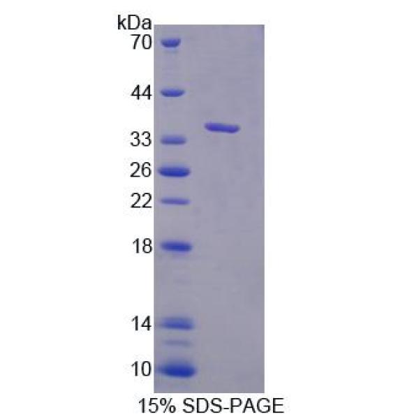 癌症易感性候选基因1(CASC1)重组蛋白(多属种)