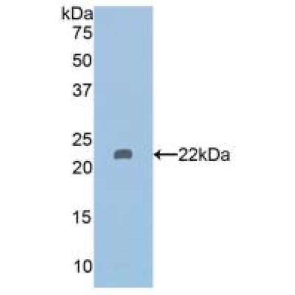 含侧支发芽因子相关EVH1域蛋白2(SPRED2)多克隆抗体