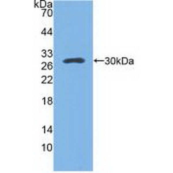 D类清道夫受体1(SCARD1)多克隆抗体