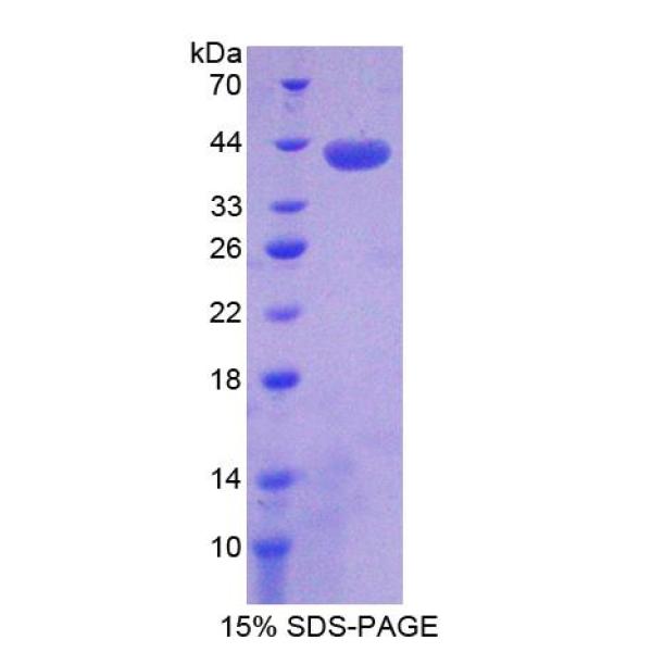 序列相似家族135成员B(FAM135B)重组蛋白(多属种)