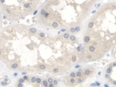 蜗管蛋白(COIL)多克隆抗体