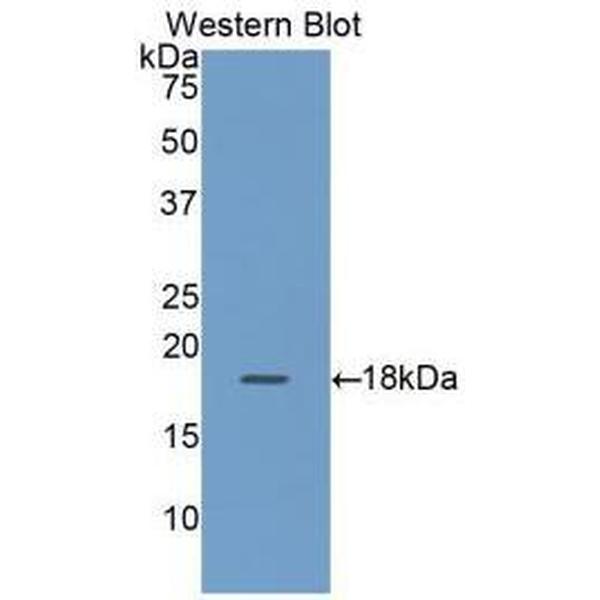 N-型电压依赖钙离子通道α1B亚基(CACNa1B)多克隆抗体