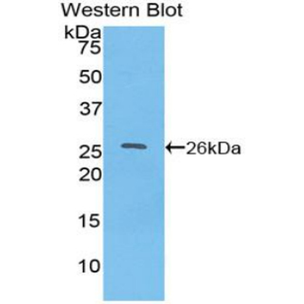 细胞分裂周期因子23(CDC23)多克隆抗体