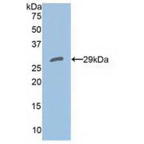 尼克酰胺腺嘌呤二核苷酸磷酸氧化酶4(NOX4)多克隆抗体