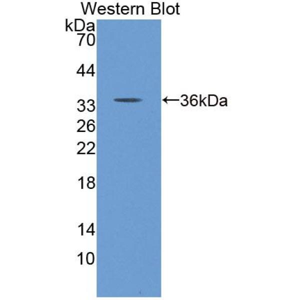细胞程序性死亡蛋白6相互作用蛋白(PDCD6IP)多克隆抗体
