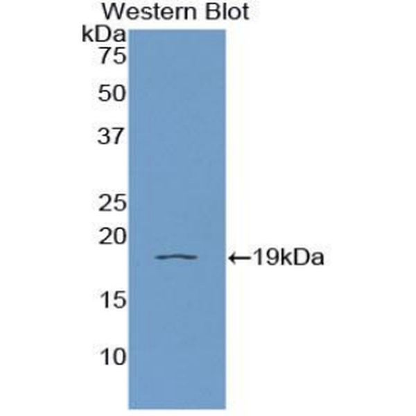 WNT1诱导信号通道蛋白1(WISP1)多克隆抗体