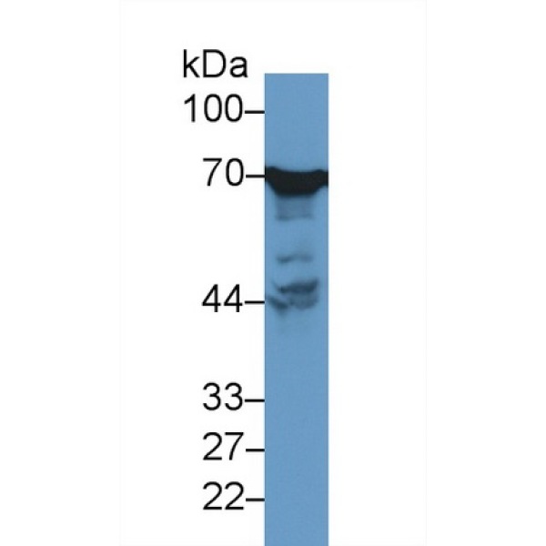 迪格弗梅尔基奥尔克劳森综合征蛋白(DYM)多克隆抗体