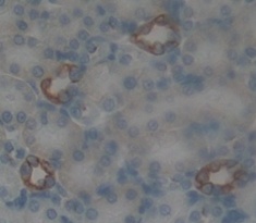 B/T-淋巴细胞衰减因子(BTLA)多克隆抗体