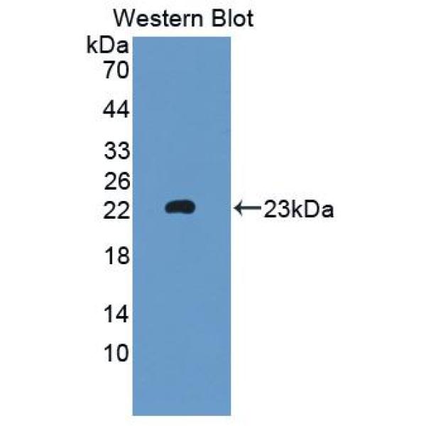 葡萄糖转运蛋白3(GLUT3)多克隆抗体