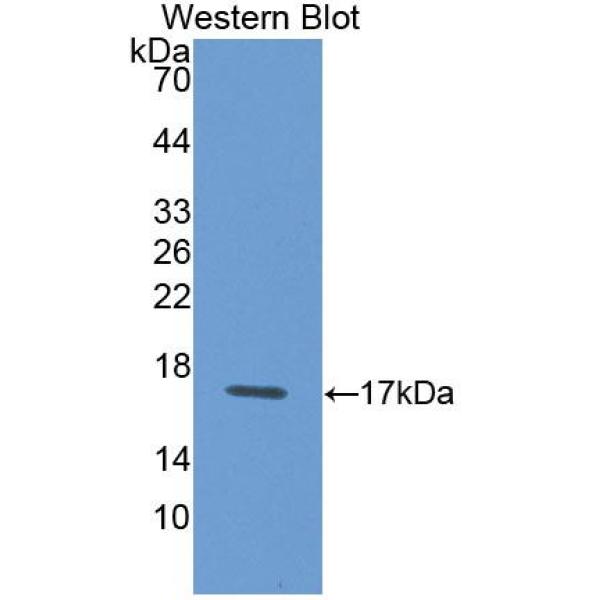 损伤特异性DNA结合蛋白2(DDB2)多克隆抗体