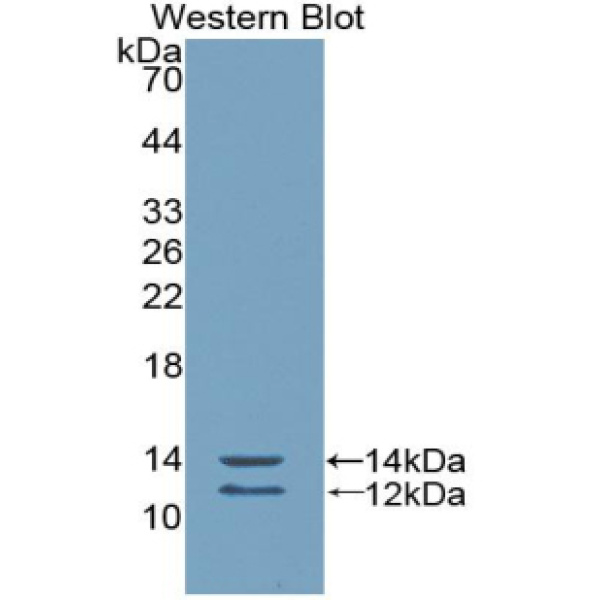 中间小电导钙激活钾离子通道亚家族N成员2(KCNN2)多克隆抗体