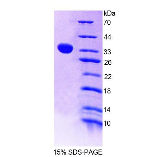 胸腺细胞核蛋白1(THYN1)重组蛋白(多属种)