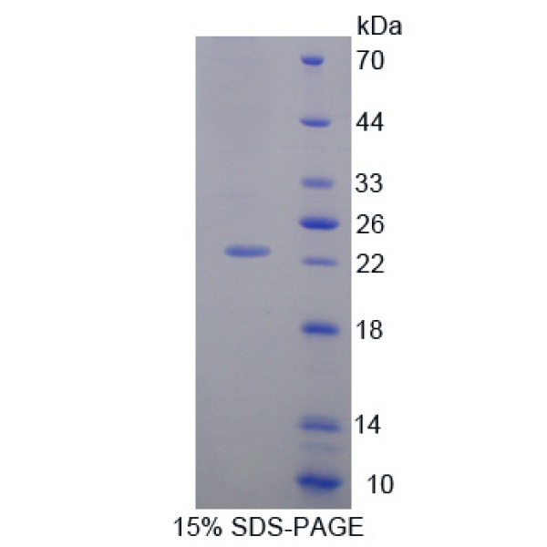 生长停滞DNA损伤可诱导蛋白α(GADD45a)重组蛋白(多属种)