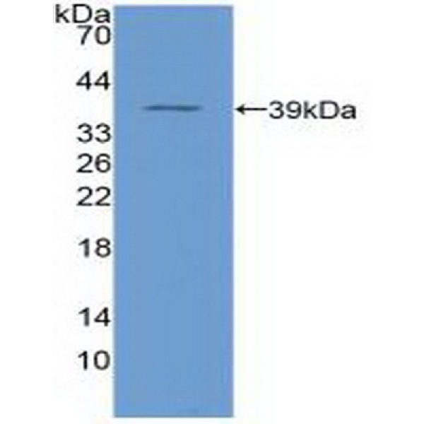 Rho GDP解离抑制因子β(ARHGDIb)多克隆抗体