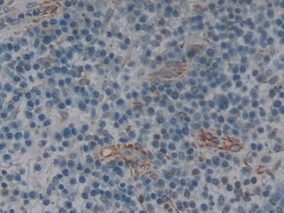 成纤维细胞激活蛋白&#945;(FAPa)多克隆抗体