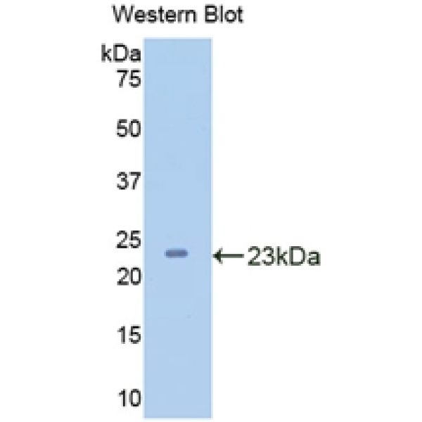 形成素结合蛋白1(FNBP1)多克隆抗体