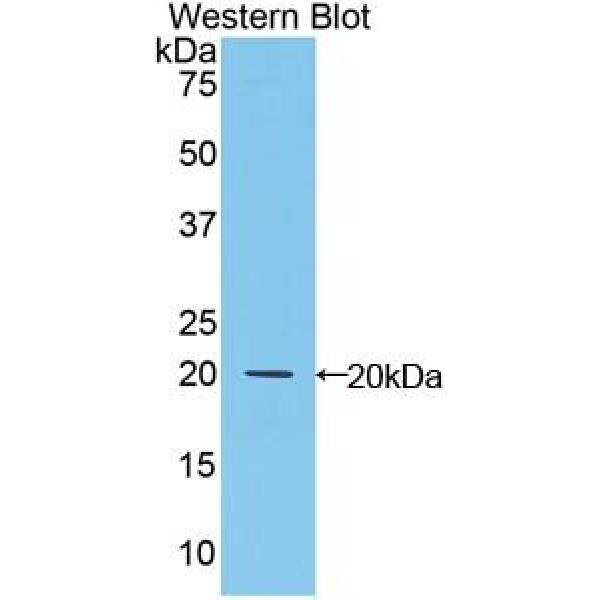 骨形成蛋白8A(BMP8A)多克隆抗体