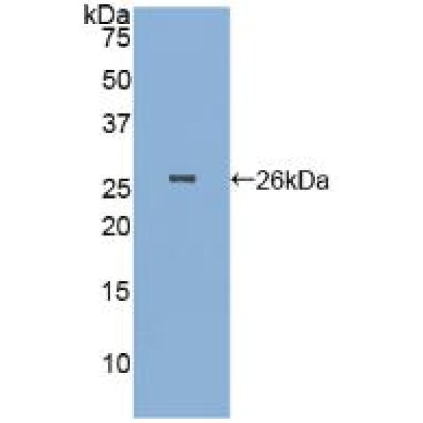转化受体电位阳离子通道亚家族M成员1(TRPM1)多克隆抗体